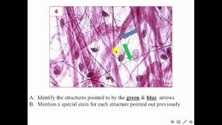 CT data show revision 2016