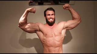 MY CURRENT CONDITION, 11 WEEKS AFTER SURGERY