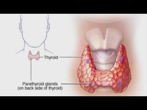 Healthcast: Dangers of high calcium