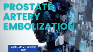 Prostatic Artery Embolization  Webinar  Basics, Techniques, Indication