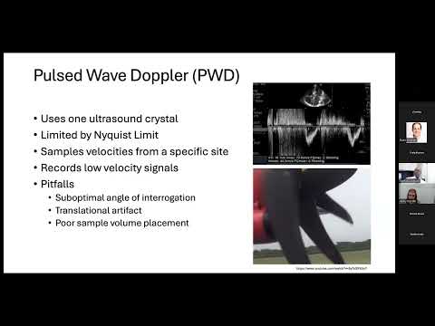 Advanced Techniques in Critical Care Echocardiography (CCE) and Point-Of-Course Ultrasound (POCUS)