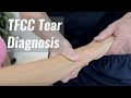 TFCC Tear Diagnosis