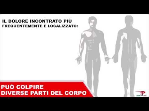Lartrosi del ginocchio carica Come raffreddori ferire i nervi nella parte posteriore