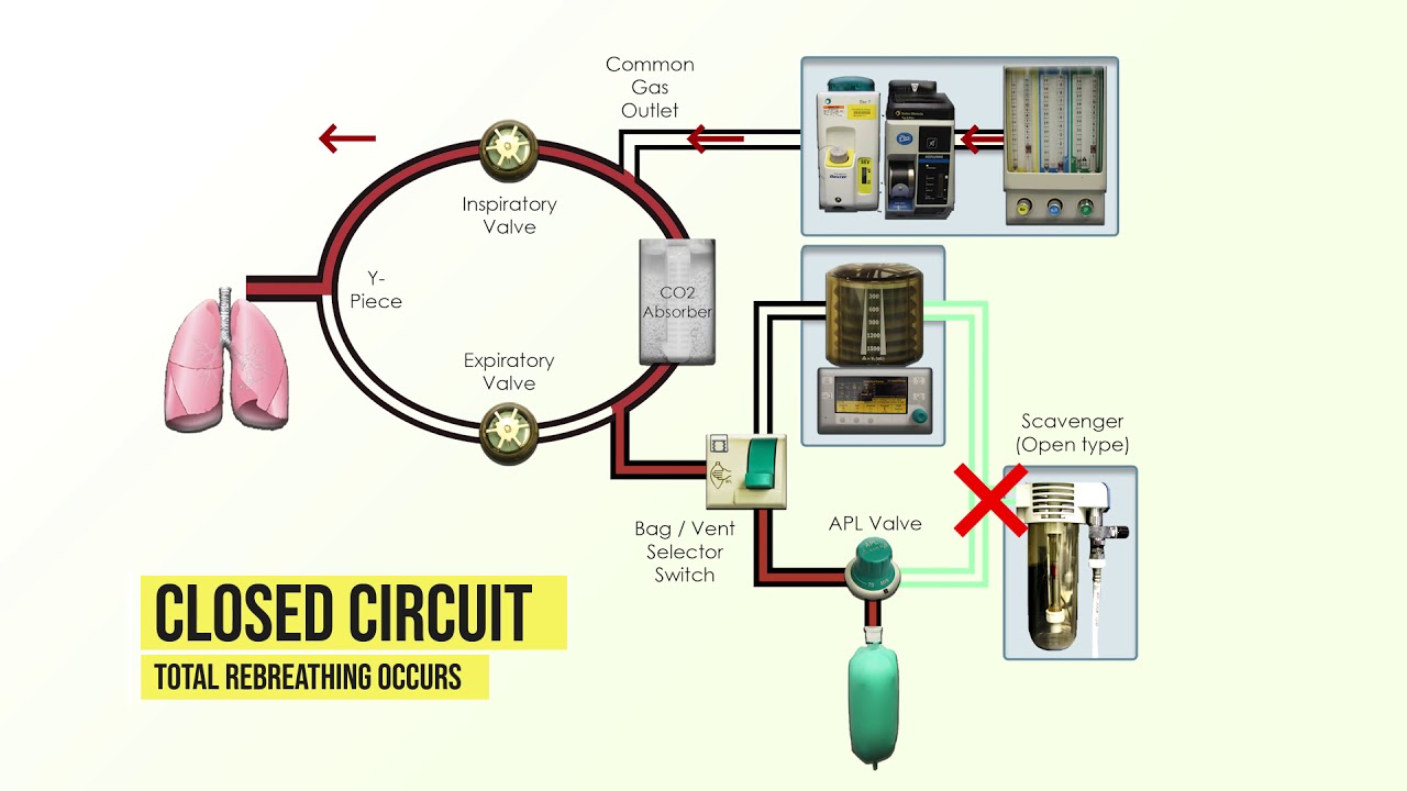 Anesthesia Machine Fundamentals