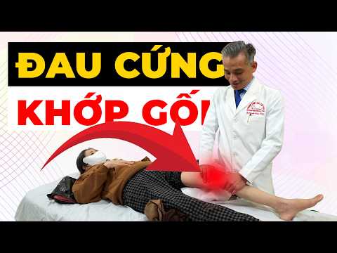 Đau cứng khớp gối do vỡ lồi cầu xương đùi. Đừng bỏ qua dấu hiệu này!
