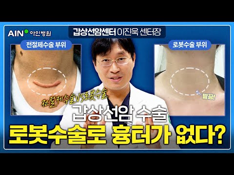  갑상선암 로봇수술 후 흉터가 없다?!ㅣ 전절제수술 vs 로봇수술🤖 (feat. 수술시간, 회복기간) ✨