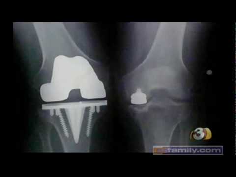 Dr. Hofstedt interview