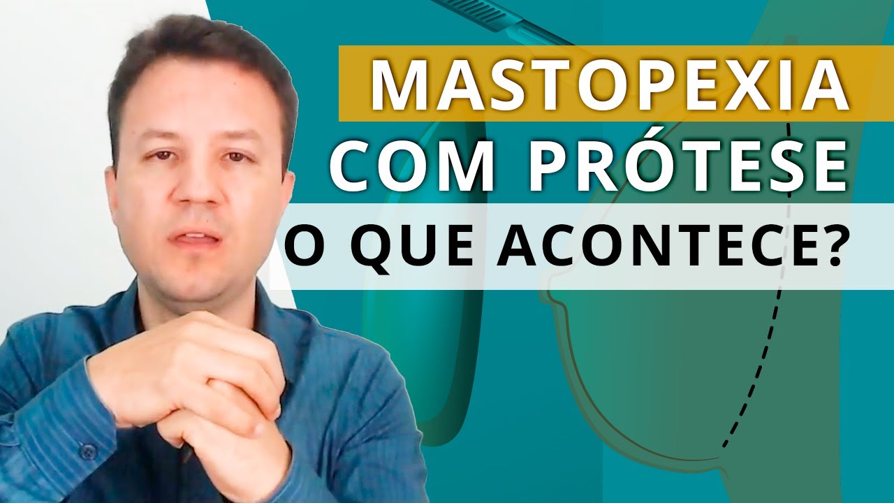 MASTOPEXIA COM PRÓTESE: O que acontece após a cirurgia?