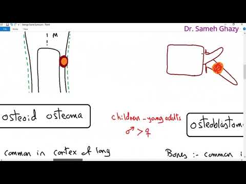 Systemic pathology 33 : bone 3 ( benign bone tumors )   DR.SAMEH GHAZY