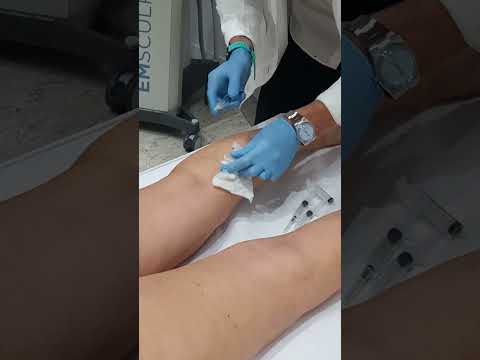 Lorenzo Marocchi-8