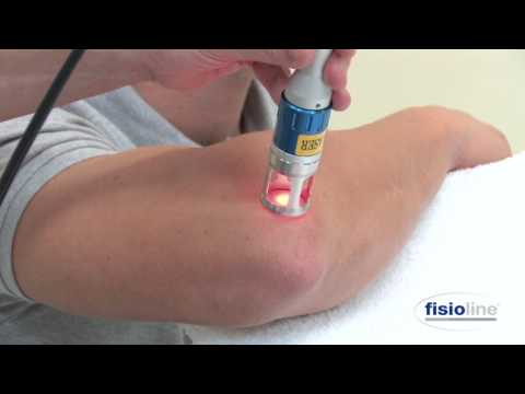 trattamento epicondilite con Laser Lumix CPS Fisioline