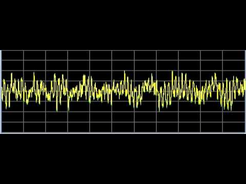 Rückenschmerzen im Bereich unterhalb der Flügel in einer horizontalen Position Ursachen In dem Hals Osteochondrose eingegeben
