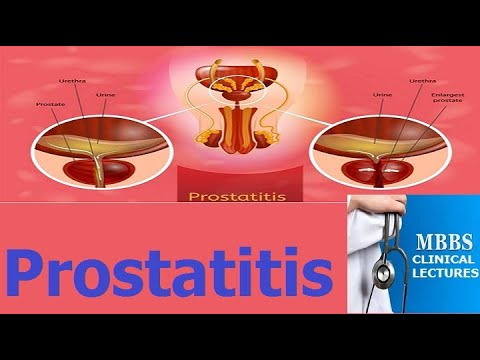Prostatita cronica se vindeca