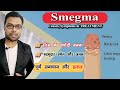Permanent Treatment For Whiteness And Foul Smell In The Penis Smegma Smegma Treatment Dr N