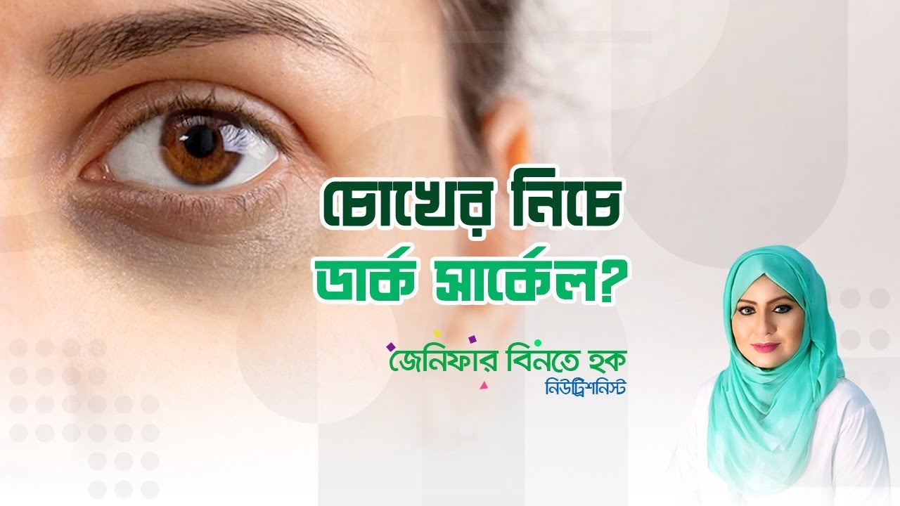 Dark circles beneath the eyes?