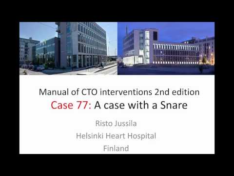 Case 77: Manual of CTO Interventions - Wire snaring and externalization