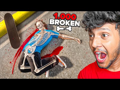 BREAKING ALL 1000 BONES As a ProfessionalBoarder!