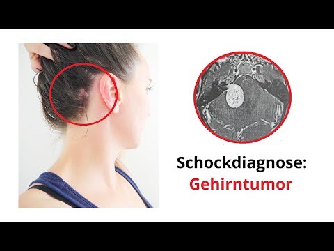 Schockdiagnose: Gehirntumor