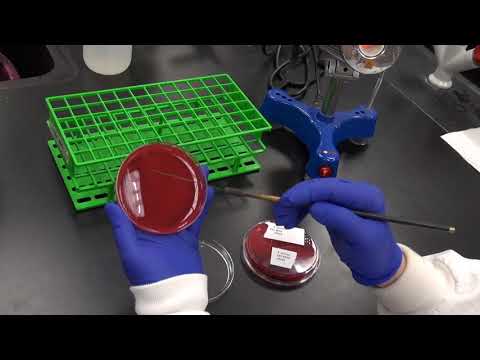 Four quadrant streak