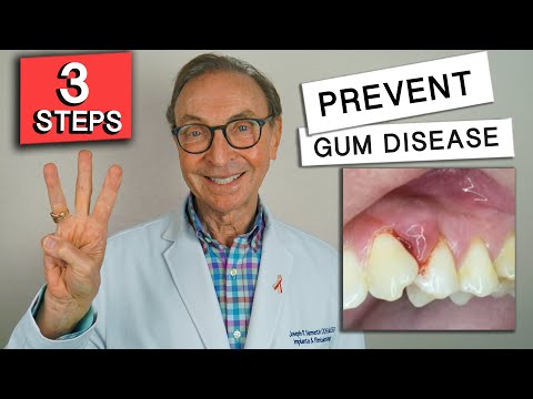 , title : '3 Easy Ways to Prevent Gum Disease at Home!'