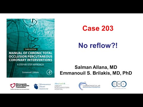 Case 203: Manual of CTO PCI - No reflow?!