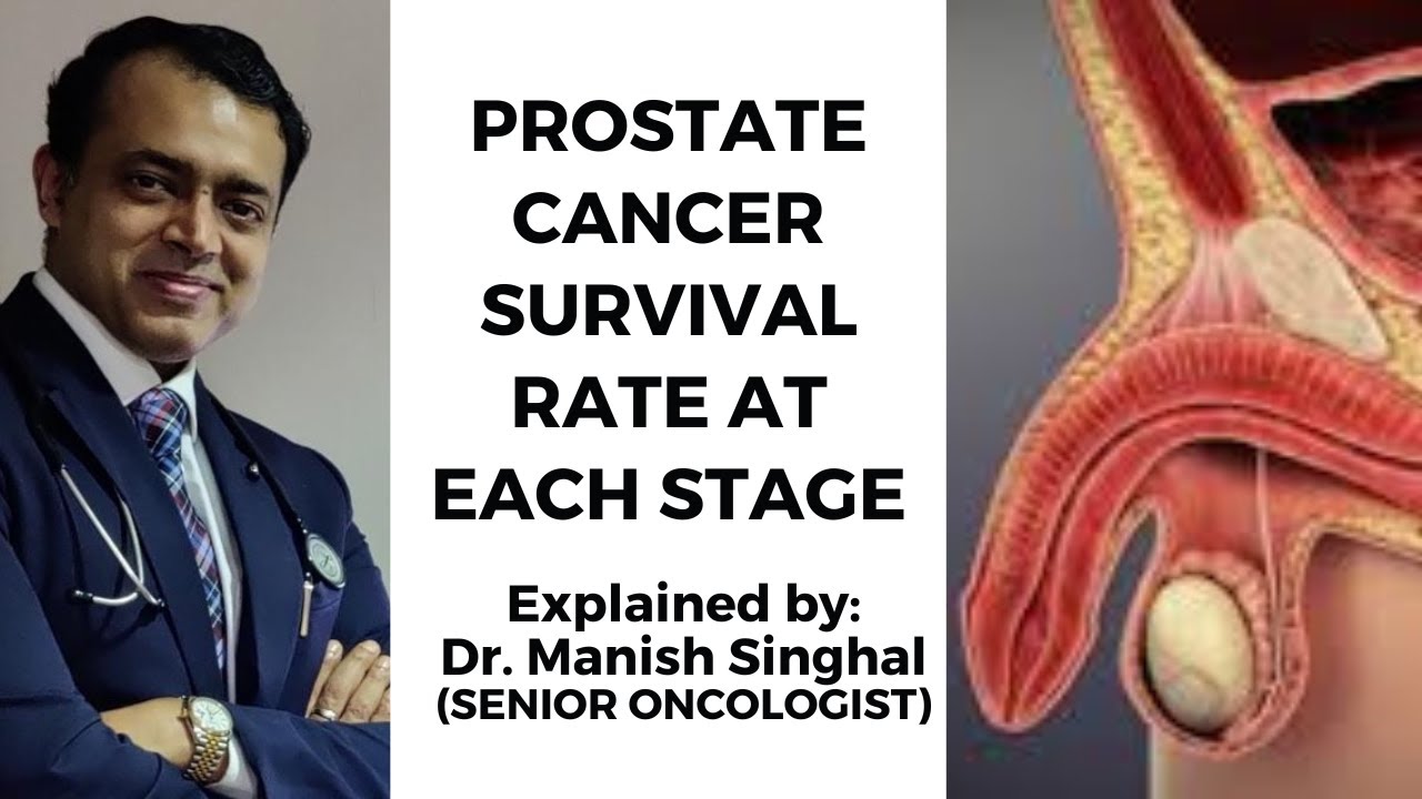 Advanced Prostate Cancer Survival Rate at Every Stage Explained