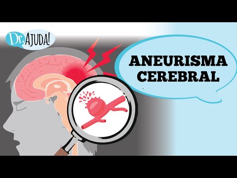 ANEURISMA CEREBRAL: QUANDO SE PREOCUPAR?
