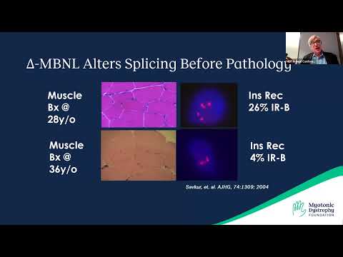 Managing Sleepiness & Other Sleep Disturbances in Myotonic Dystrophy - 2023 MDF Annual Conference
