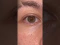 3 Colored Eyes? Less Than 1% of Population Have This Disease - Do You Have Central Heterochromia?