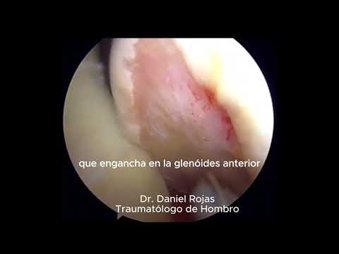 Daniel Rojas Castillo-38