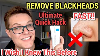 REMOVE SEBACEOUS FILAMENTS FAST - Blackhead Removal With La Roche-Posay Cicaplast Baume