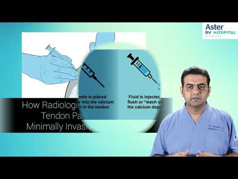 Calcific Tendonitis | Dr. Amogh V N | Aster RV