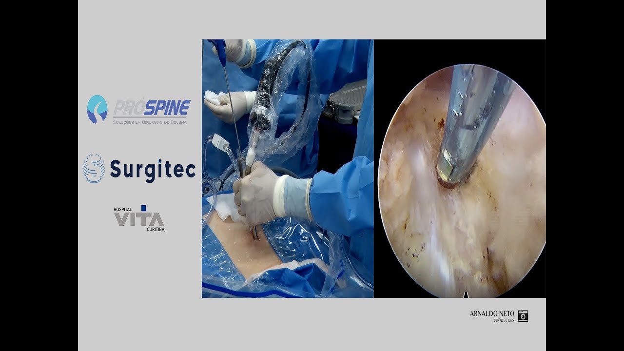 Álynson Larocca Kulcheski-112