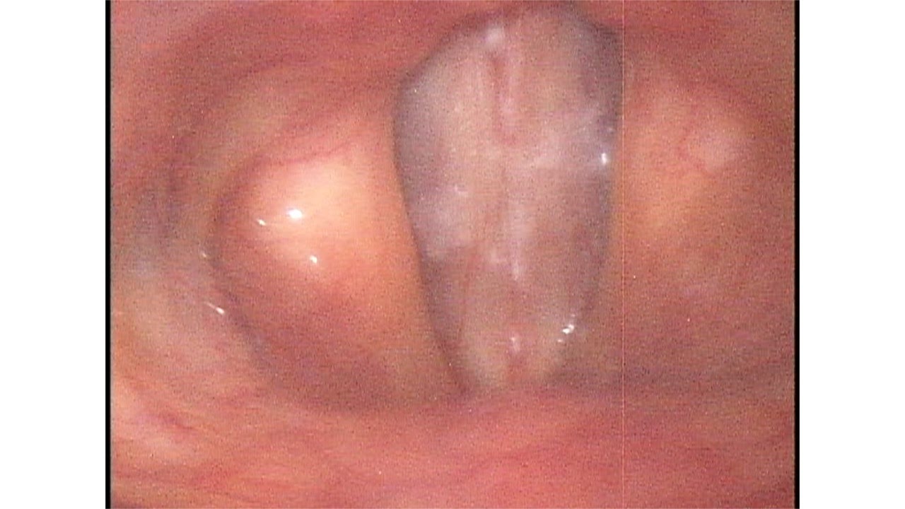 Joaquín Archibaldo Hope Guerrero-16