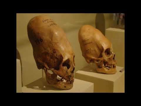 ДЛR#1123. Мозг пятого размера