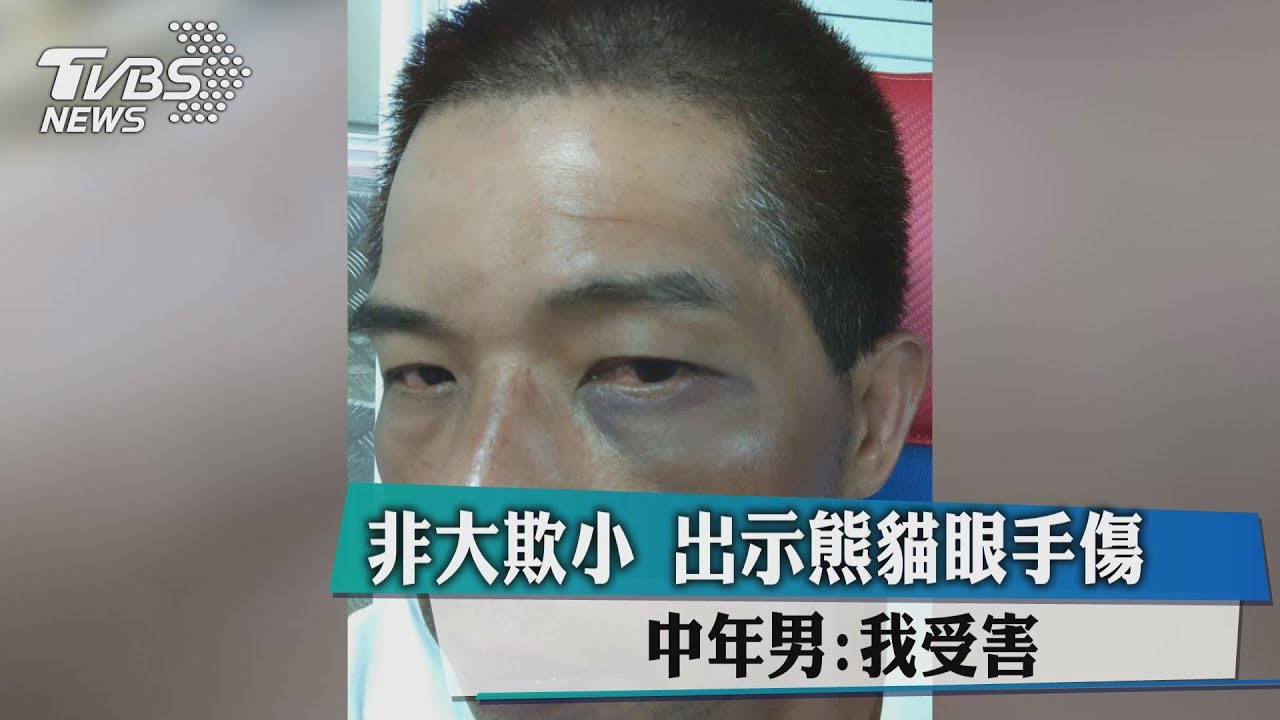 非大欺小出示熊貓眼、手傷　中年男：我受害