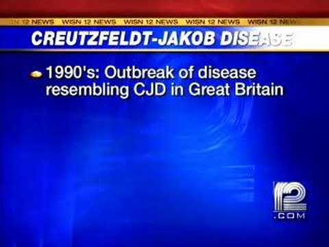 What Is Creutzfeldt-Jakob Disease?