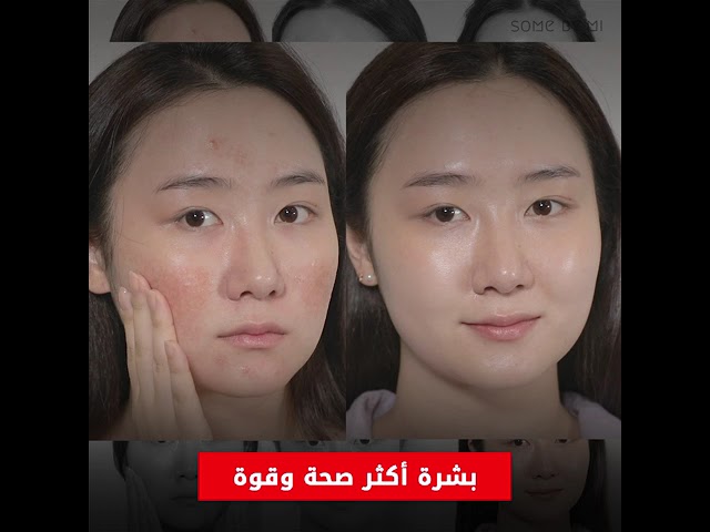 كريم تروسيكا الحلزون لإصلاح البشرة