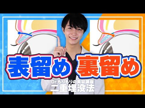 【二重整形】裏留めと表留めって一体なにが違うの？？メリットとデメリット、美容整形のリアルを教えます！