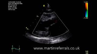 Download the video "rcm2"