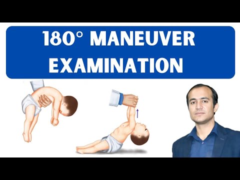 How to Perform the 180° Maneuver & Examine a Floppy Child | Pediatric Neurology Exam