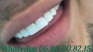 Hollywood smile Oujda
