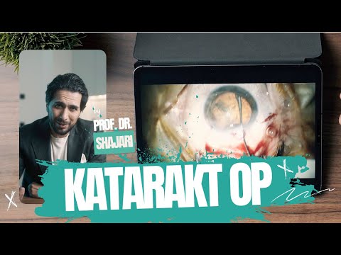 Cataract surgery - How does the operation work?!