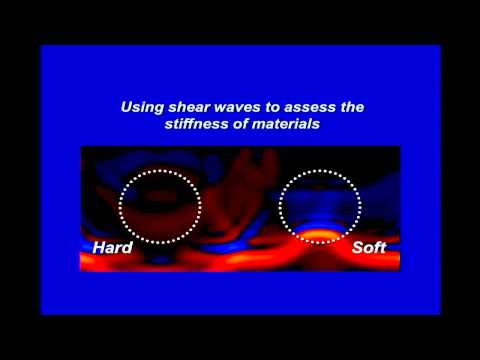 5th Annual TMII Symposium - 2015 - Session IV - Cancer & Body Imaging