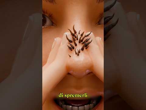 HOW TO REMOVE A BLACKHEAD (Credits: ​⁠@TheOutliners.)