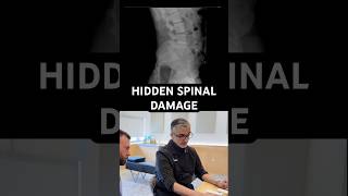 He Tried EVERYTHING For His Whole Body PAIN Before This @DrRahim