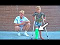 Tydus BROKE HIS LEG Hospital
