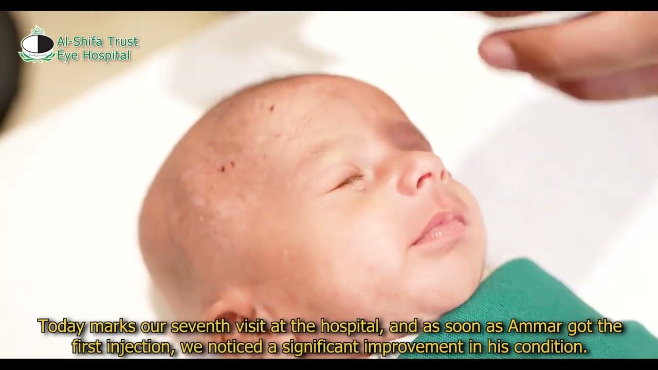 Ammar Haseeb | ROP Patient | Paeds | Al-Shifa Trust Eye Hospital