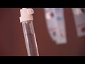 Chemotherapy offers clues for potential HIV cure