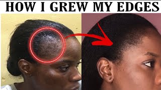 HOW TO GROW EDGES BACK THE NATURAL WAY|HOME REMEDY|HAIR JOURNEY